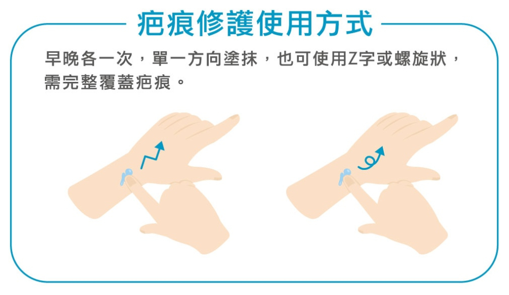 喜療疤 疤痕護理矽凝膠
